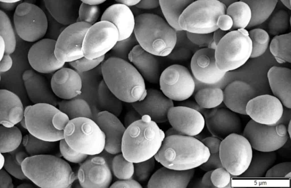 Scanning electron microscope image of Saccharomyces cerevisiae yeast used in brewing fermentation