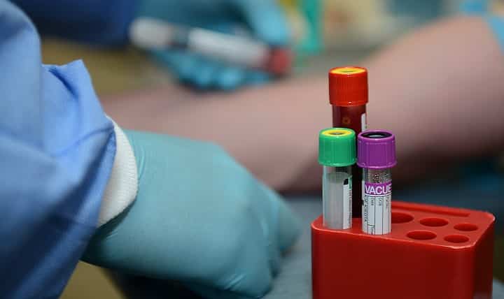 Medical blood sample vials requiring precise temperature-controlled storage and laboratory cooling