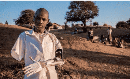 Daniel Omar, a boy who received a 3D-printed prosthetic arm manufactured using EDM and precision machining